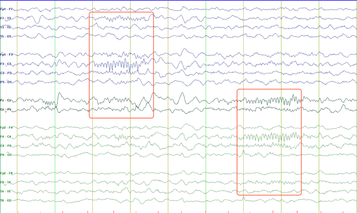 Eeg professionals health