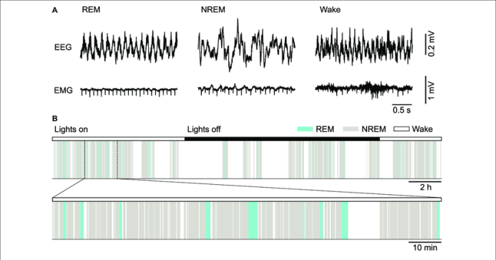 A state of as shown by eeg