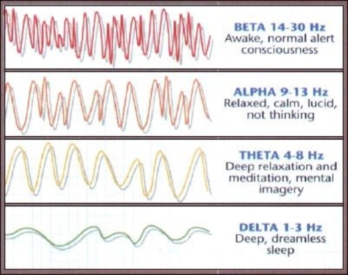 Eeg asynchronous asymmetric findings ss they