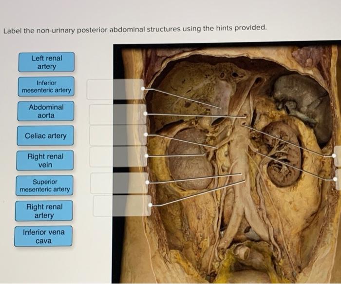 Label the urinary posterior abdominal structures using the hints provided.