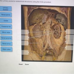 Abd urology endo pelvic flashcards cram