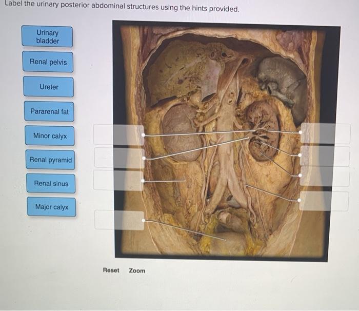 Abd urology endo pelvic flashcards cram