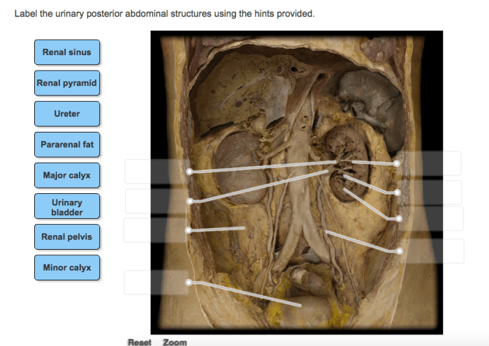 Label the urinary posterior abdominal structures using the hints provided.